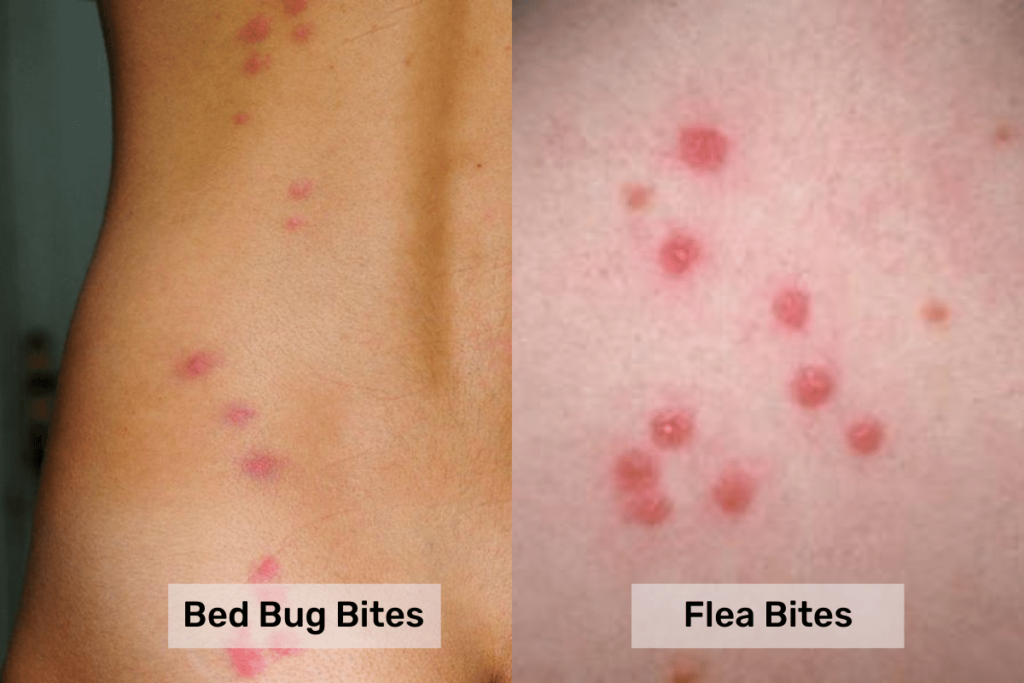 bed-bugs-bite-vs-flea-bite-what-s-the-difference-pest-control-gurus