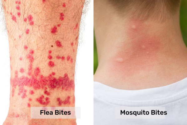 flea-bites-vs-mosquito-bites-pest-control-gurus